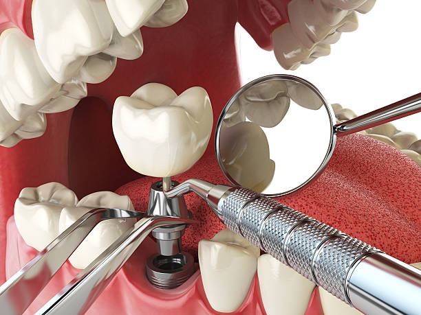 Best Walk-In Emergency Dentist in Kingsville, TX